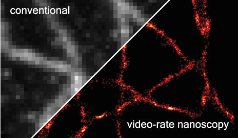 Yale scientists develop video-rate nanoscopy to peer deep into a cell in real time | Daily Magazine | Scoop.it