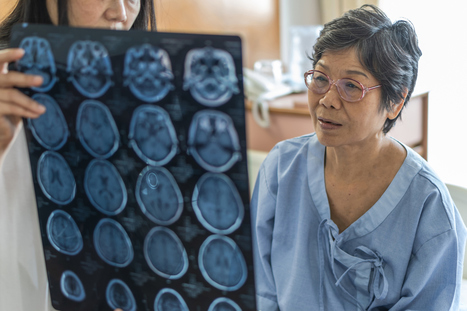More Evidence that Bilingualism Delays Symptoms of Alzheimer’s | Bilingually Enriched Learners | Scoop.it