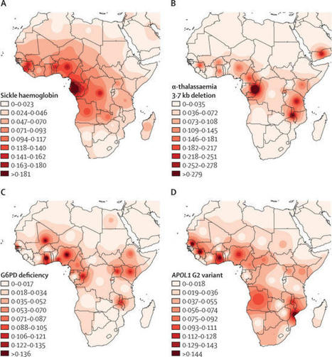 Sickle cell disease in sub-Saharan Africa: transferable strategies for prevention and care | Hematology | Scoop.it