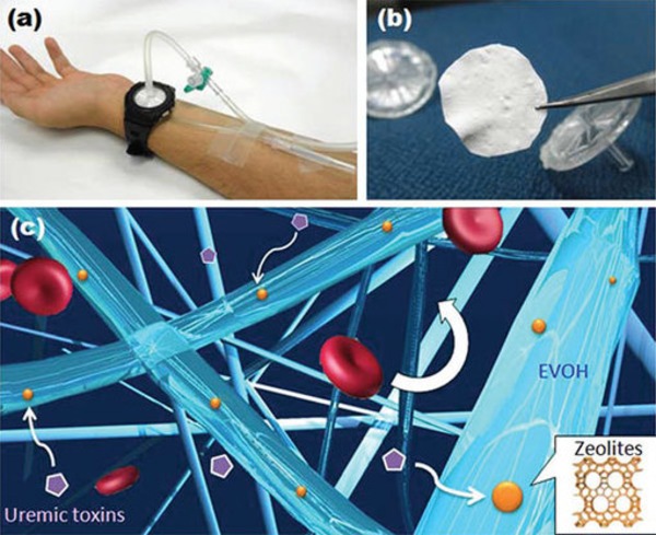 Nanofiber Mesh Filters Blood of Toxins, May Allow for Tiny Hemodialysis Machines | Peritoneal dialysis | Scoop.it
