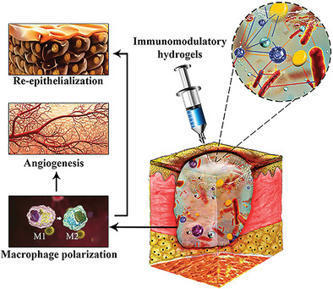 Rational Design of Immunomodulatory Hydrogels for Chronic Wound Healing | Tailored Expertise Sourcing & Market Intelligence in Global Consulting | Scoop.it