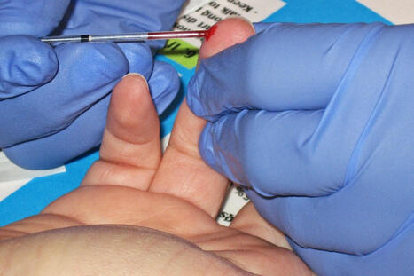 Diabetic PCI patients have a higher risk of stent failure without glycaemic control | Daily realities of diabetic patients | Scoop.it