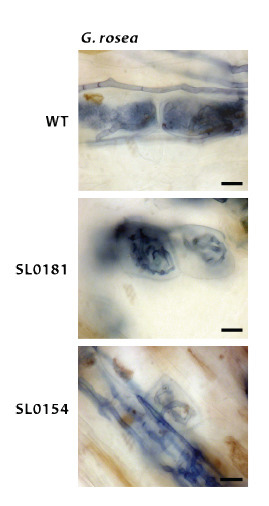 Two Lotus japonicus symbiosis mutants impaired at distinct steps of arbuscule development | Plant-Microbe Symbiosis | Scoop.it