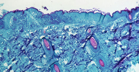 The Mystery of Monkeypox’s Global Spread  | Imagine Online International Education | Scoop.it