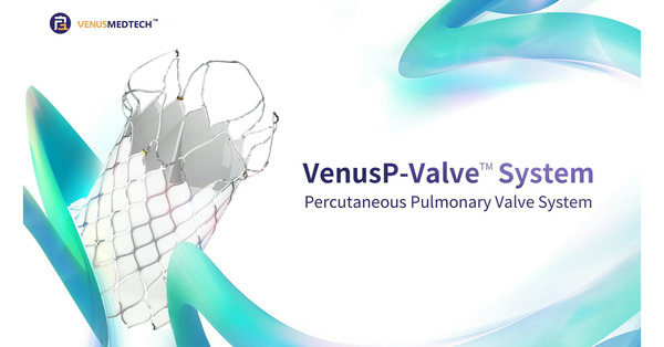 Venus Medtech VenusP-Valve transcatheter pulmonic valve replacement system granted Health Canada approval | Transcatheter Treatment of Mitral Regurgitation | Scoop.it