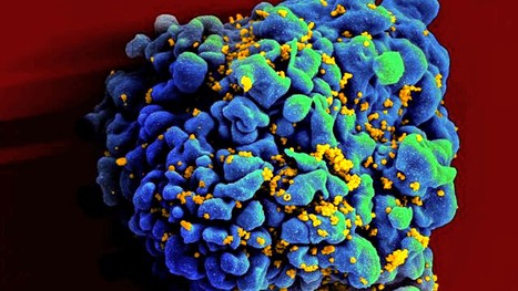 Mooc "HIV Science" - Institut Pasteur | sida | Scoop.it