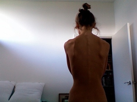 People With Eating Disorders Can't Be Left Without A Lifeline | Physical and Mental Health - Exercise, Fitness and Activity | Scoop.it