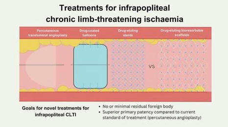 Current Status of and Future Prospects for Drug-Eluting Stents and Scaffolds in Infrapopliteal Arteries | Critical Limb-Threatening Ischemia (CLTI) | Scoop.it