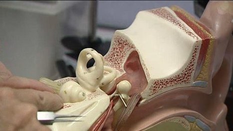 Des chercheurs clermontois et parisiens en passe de trouver un rem&egrave;de &agrave; la surdit&eacute; - France 3 Auvergne | Revue de presse Implant Cochl&eacute;aire | Scoop.it