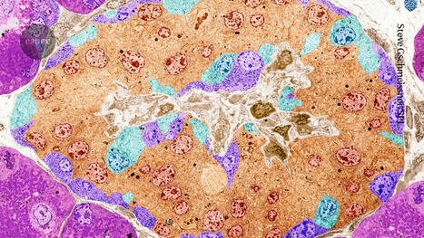 Hope for diabetes: CRISPR-edited cells pump out insulin in a person — and evade immune detection - Nature | Genetic Engineering in the Press by GEG | Scoop.it