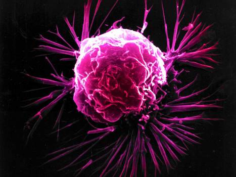 Cancer Database Launched in UK | Cancer - Advances, Knowledge, Integrative & Holistic Treatments | Scoop.it