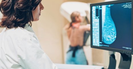 Google's AI Bested Doctors in Reading Mammograms | Hospitals and Healthcare | Scoop.it