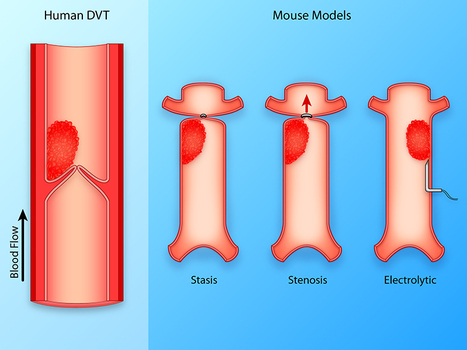 Critical Review of Mouse Models of Venous Thrombosis | Critical Limb-Threatening Ischemia (CLTI) | Scoop.it