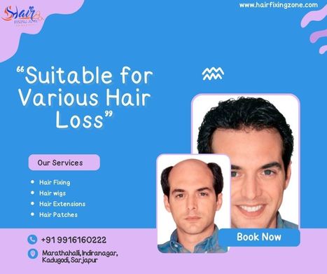Hair Patches Suitable for Various Types of Hair Loss | hair fixing in bangalore | Scoop.it