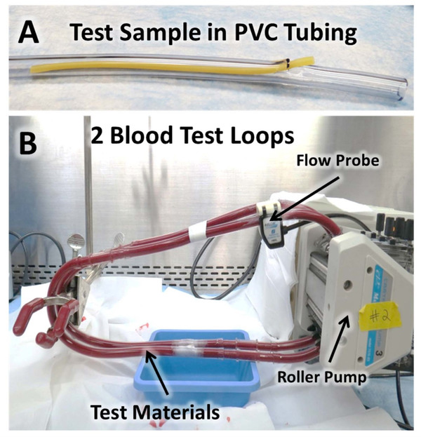 An In Vitro Blood Flow Loop System for Thrombogenicity Evaluation of Medical Devices and Biomaterials | Neurovascular Intervention | Scoop.it