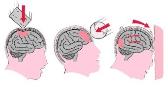 Menos cárceles y más neuropsiquiatría, ¡que estamos en el siglo XXI! | Educación, TIC y ecología | Scoop.it