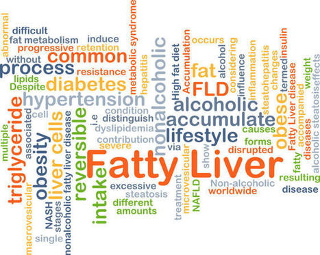 Preventable liver disease is rising: What you eat &mdash; and avoid &mdash; counts | Salud Publica | Scoop.it