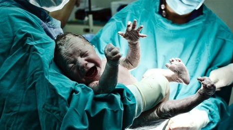 Grossesse extra-utérine : naissance rarissime d’un bébé viable qui a grandi dans l’ovaire de sa mère | Famille et sexualité | Scoop.it