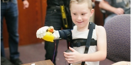 Une prothèse de bras réalisée par imprimante 3 D pour Alex ! | FabLab | Scoop.it