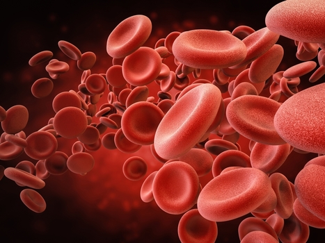 Functional Neurology: Iron Deficiency Anemia and Brain Health | El Paso, TX Chiropractor | Call: 915-850-0900 | Neuropathy "The Painful Enigma" | Scoop.it