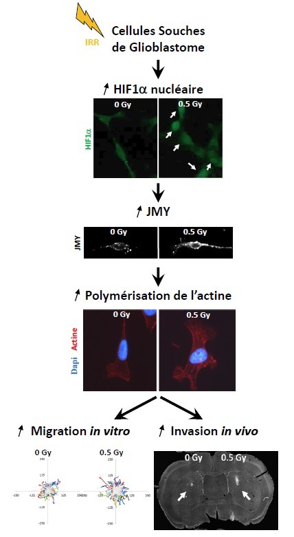 Les radiations ionisantes stimulent la migration des cellules souches de glioblastome via la voie moléculaire HIF1α/JMY | Life Sciences Université Paris-Saclay | Scoop.it