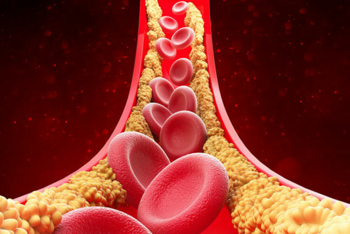 Here's what actually causes high cholesterol (and how to cut it) | The Health Report | Scoop.it