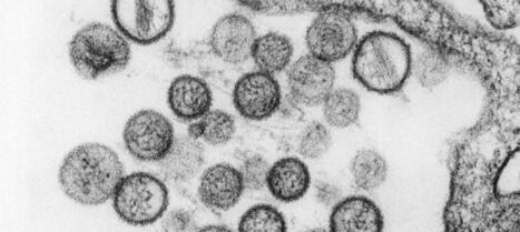 La maladie - Recommandations CNR Hantavirus | Prof. J&eacute;r&ocirc;me S. | H&eacute;sitations Vaccinales: Observatoire HESIVAXs | Scoop.it