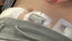 Artificial pancreas gives girl a vacation from diabetes - CNN.com | Science News | Scoop.it