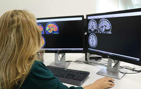 La PET de amiloide facilita el diagnóstico precoz y certero del Alzheimer | Alzheimer y más (Boletín nº 70) | Scoop.it