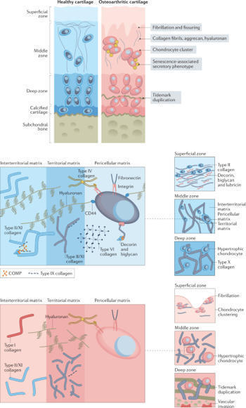 Mechanosignalling in cartilage: an emerging target for the treatment of osteoarthritis | Nature Reviews Rheumatology | Rheumatology-Rhumatologie | Scoop.it