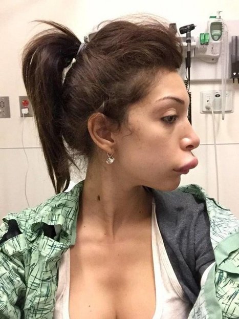 Ce superbe fail de chirurgie esthétique monte d’un cran dans le WTF | Trollface , meme et humour 2.0 | Scoop.it
