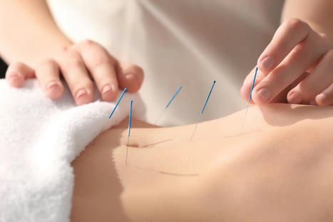 Discover How Acupuncture Reduces Gut Inflammation | Call: 915-850-0900 | The Gut "Connections to Health & Disease" | Scoop.it