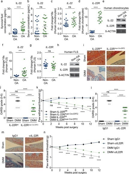 Targeting IL-22 and IL-22R protects against experimental osteoarthritis | Rheumatology-Rhumatologie | Scoop.it