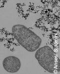 Nanoparticules de dioxyde de titane dans l’alimentation (additif E 171) : des effets biologiques qui doivent être confirmés | ANSES | Prévention du risque chimique | Scoop.it