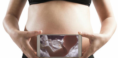 Microplastiques, grossesse et placenta : ce que nous savons et ce que nous ignorons encore | Planète DDurable | Scoop.it