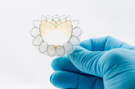 Tiara Mitral Valve Replacement Passes Preclinical Study | Transcatheter Treatment of Mitral Regurgitation | Scoop.it