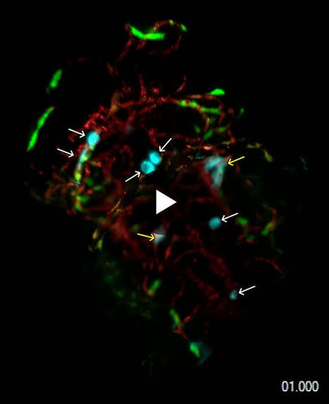 Breast Cancer Cells Leave Bloodstream in Zebrafish | Kandice Tanner Ph.D. posted on the topic | from Flow Cytometry to Cytomics | Scoop.it