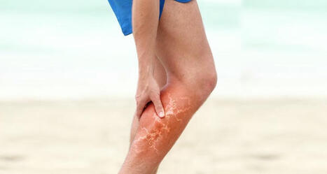 How is Critical Limb Ischemia treated? | Critical Limb-Threatening Ischemia (CLTI) | Scoop.it