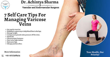 Revitalize Your Legs: Find 7 Proven Strategies of Self-Care for Getting Rid of Spider and Snakey Veins | Dr. Achintya Sharma - Vascular and Endovascular Surgeon | Scoop.it