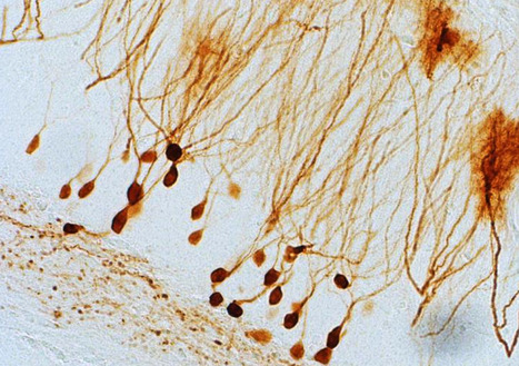 New Adeno-associated virus (AAV) Gene Therapy for Epilepsy | Virus World | Scoop.it