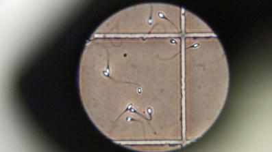 Yksi mies on saattanut aiheuttaa satojen lasten riskin syövälle | 1Uutiset - Lukemisen tähden | Scoop.it