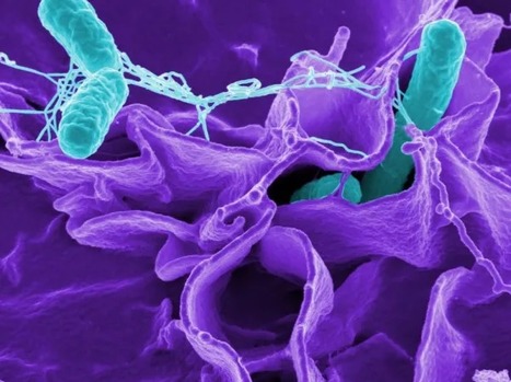 Salmonelles, Listeria, E. Coli : zoom sur 3 bactéries présentes dans nos assiettes | Lait de Normandie... et d'ailleurs | Scoop.it