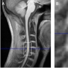 Unhurtful Thoughts: A Preoccupied Brain Produces Pain-Killing Compounds: Scientific American | Science News | Scoop.it