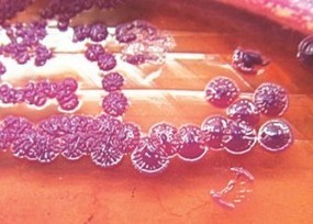 Deadly bacteria in Gazipur soil | The Asian Food Gazette. | Scoop.it