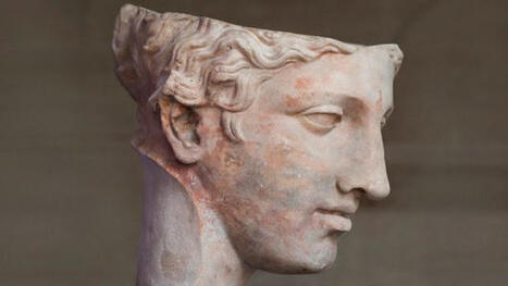 Why don't we know more about migraines? | Hospitals and Healthcare | Scoop.it