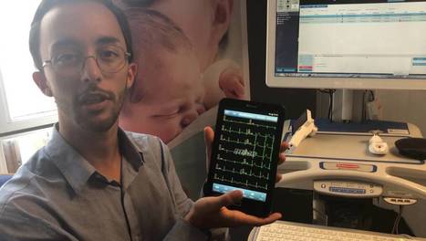VIDEO. La télémédecine pour améliorer l’accès aux soins en Sarthe | Télémédecine | Scoop.it