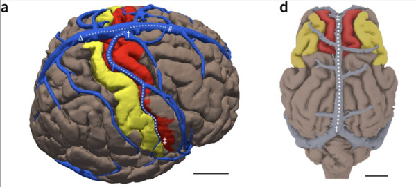 Minimally invasive endovascular stent-electrode array for high-fidelity, chronic recordings of cortical neural activity  | Brain Computer Interfaces & connected medical devices | Scoop.it