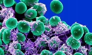 RAFT: making better polymers - CSIRO | Science (to support Australian Curriculum) | Scoop.it