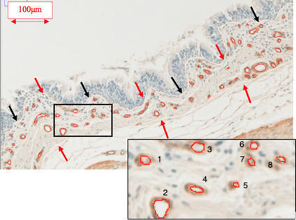 Bronchial angiogenesis in horses with severe asthma and its response to corticosteroids - Millares‐Ramirez - - Journal of Veterinary Internal Medicine | Allergy (and clinical immunology) | Scoop.it