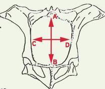 Vulgariser la pelvim&eacute;trie pour trier les g&eacute;nisses | Actualit&eacute;s de l'&eacute;levage | Scoop.it